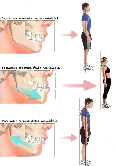 Denti: hanno importanza con la postura?